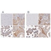 Anti-SERPINA1 antibody produced in rabbit Prestige Antibodies&#174; Powered by Atlas Antibodies, affinity isolated antibody, buffered aqueous glycerol solution