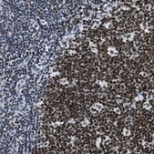 Anti-TOP1 antibody produced in rabbit Prestige Antibodies&#174; Powered by Atlas Antibodies, affinity isolated antibody, buffered aqueous glycerol solution
