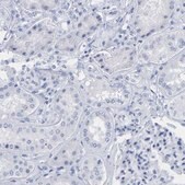 Anti-KRT1 antibody produced in rabbit Prestige Antibodies&#174; Powered by Atlas Antibodies, affinity isolated antibody, buffered aqueous glycerol solution