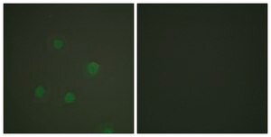 Anti-Progesterone Receptor antibody produced in rabbit affinity isolated antibody