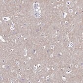 Anti-GABBR2 antibody produced in rabbit Prestige Antibodies&#174; Powered by Atlas Antibodies, affinity isolated antibody, buffered aqueous glycerol solution