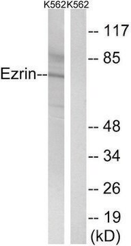 Anti-Ezrin antibody produced in rabbit affinity isolated antibody