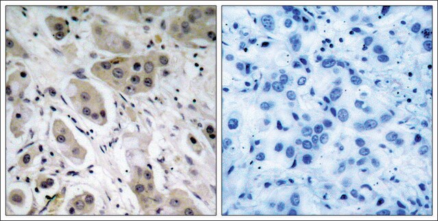 Anti-phospho-AKT1 (pSer473) antibody produced in rabbit affinity isolated antibody