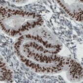 Monoclonal Anti-ESR1 antibody produced in mouse Prestige Antibodies&#174; Powered by Atlas Antibodies, clone CL1196, purified immunoglobulin, buffered aqueous glycerol solution