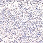 Anti-Phospho-Jak2-Y1007/1008 antibody produced in rabbit