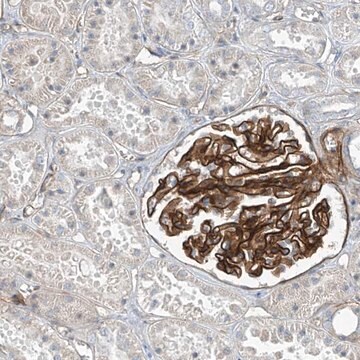 Anti-TNS2 antibody produced in rabbit Prestige Antibodies&#174; Powered by Atlas Antibodies, affinity isolated antibody, buffered aqueous glycerol solution