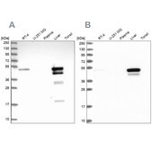 Anti-ABAT antibody produced in rabbit Prestige Antibodies&#174; Powered by Atlas Antibodies, affinity isolated antibody, buffered aqueous glycerol solution