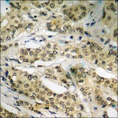 Anti-phospho-MAP3K1 (pThr1402) antibody produced in rabbit affinity isolated antibody
