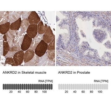 Anti-ANKRD2 antibody produced in rabbit Prestige Antibodies&#174; Powered by Atlas Antibodies, affinity isolated antibody, buffered aqueous glycerol solution