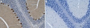 Anti-p-PKC&#947; (Thr514) Antibody, clone 4F20 ZooMAb&#174; Rabbit Monoclonal recombinant, expressed in HEK 293 cells