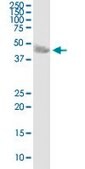 Anti-CA14 antibody produced in mouse purified immunoglobulin, buffered aqueous solution