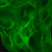 U2OS GFP-ACTB RFP-TUBA1B