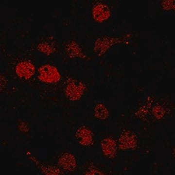 Anti-phospho BRD4 (Ser492) from rabbit