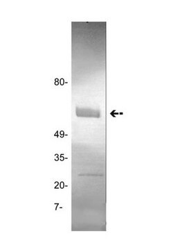 Anti-tPA (Tissue Plasminogen Activator) Antibody, clone GMA-043 clone GMA-043, Upstate&#174;, from mouse