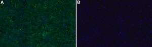 Anti-CYP11B1 Antibody, clone 1J14 ZooMAb&#174; Rabbit Monoclonal recombinant, expressed in HEK 293 cells