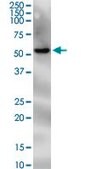 Monoclonal Anti-PNPLA2 antibody produced in mouse clone 2H1, purified immunoglobulin, buffered aqueous solution
