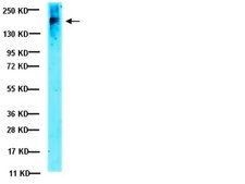 Anti-CFTR Antibody, clone MM13-4 clone MM13-4, Upstate&#174;, from mouse