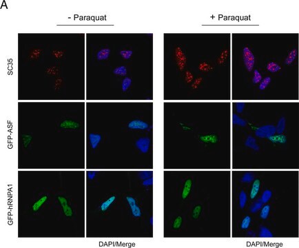 Monoclonal Anti-Splicing Factor SC-35 antibody produced in mouse clone SC-35, ascites fluid