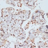 Anti-Phospho-CHEK1-S280 antibody produced in rabbit