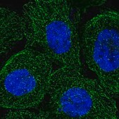 Anti-SYNJ2 antibody produced in rabbit Prestige Antibodies&#174; Powered by Atlas Antibodies, affinity isolated antibody, buffered aqueous glycerol solution