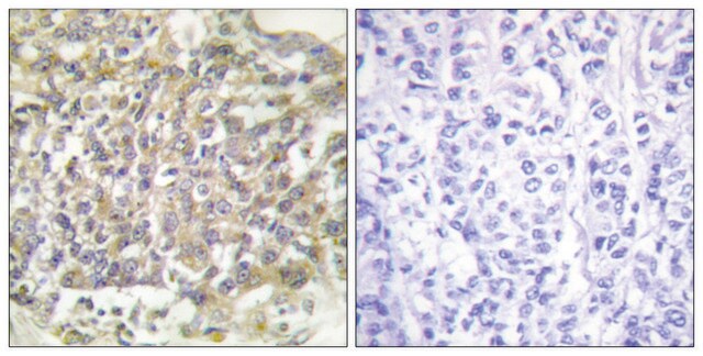 Anti-SHC antibody produced in rabbit affinity isolated antibody