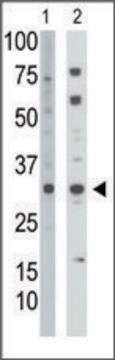 Anti-TK2 (C-term) antibody produced in rabbit IgG fraction of antiserum, buffered aqueous solution