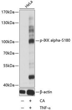 Anti-Phospho-IKK alpha-S180 antibody produced in rabbit