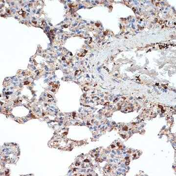 Anti-SR-B2/LIMPII antibody produced in rabbit