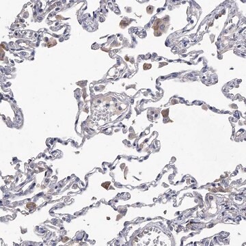 Anti-C5 antibody produced in rabbit Prestige Antibodies&#174; Powered by Atlas Antibodies, affinity isolated antibody, buffered aqueous glycerol solution