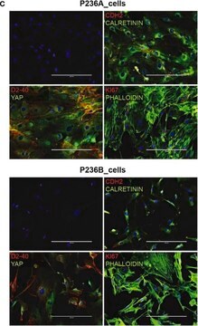 Anti-CALB2 antibody produced in rabbit Prestige Antibodies&#174; Powered by Atlas Antibodies, affinity isolated antibody, buffered aqueous glycerol solution