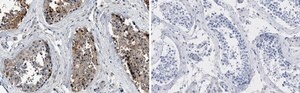 Anti-PKM2 Antibody, clone 1B2 ZooMAb&#174; Rabbit Monoclonal recombinant, expressed in HEK 293 cells