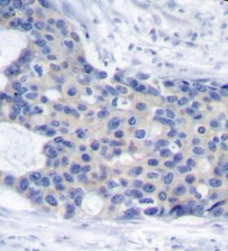 Anti-Phospho-ZAP70-Y493 antibody produced in rabbit
