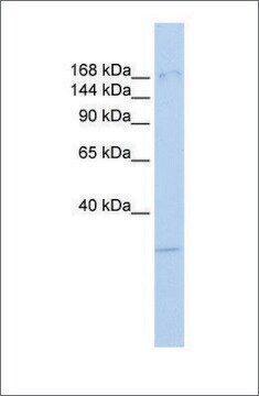 Anti-UTX antibody produced in rabbit affinity isolated antibody
