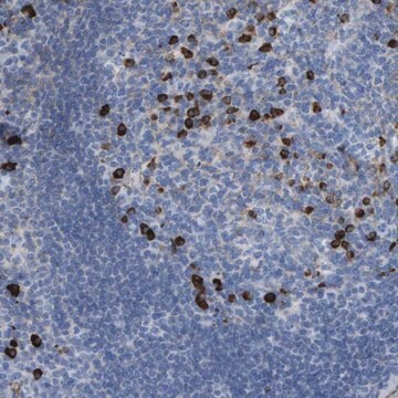 Anti-IFNAR1 antibody produced in rabbit Prestige Antibodies&#174; Powered by Atlas Antibodies, affinity isolated antibody, buffered aqueous glycerol solution