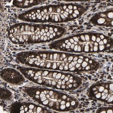 Anti-ZCCHC7 antibody produced in rabbit Prestige Antibodies&#174; Powered by Atlas Antibodies, affinity isolated antibody, buffered aqueous glycerol solution, Ab1