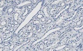 Anti-KIF5B Antibody, clone 2F23 ZooMAb&#174; Rabbit Monoclonal recombinant, expressed in HEK 293 cells