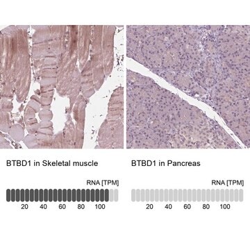 Anti-BTBD1 antibody produced in rabbit Prestige Antibodies&#174; Powered by Atlas Antibodies, affinity isolated antibody, buffered aqueous glycerol solution