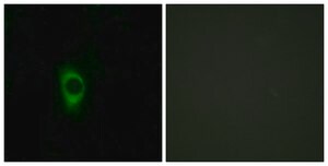 Anti-5-HT-2B antibody produced in rabbit affinity isolated antibody