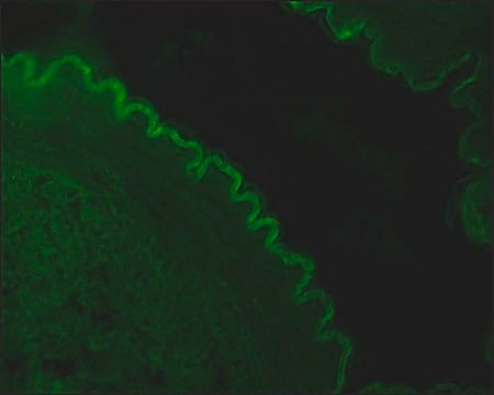 Monoclonal Anti-Cytokeratin Peptide 4 antibody produced in mouse clone 6B10, ascites fluid