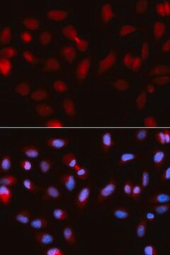 Anti-Survivin antibody produced in rabbit