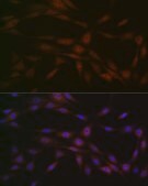Anti-Casein Kinase 2 beta (CSNK2B) Antibody, clone 9T5J10, Rabbit Monoclonal
