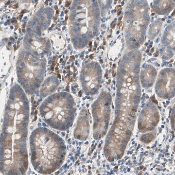 Anti-MPI antibody produced in rabbit Prestige Antibodies&#174; Powered by Atlas Antibodies, affinity isolated antibody, buffered aqueous glycerol solution