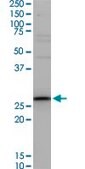 Monoclonal Anti-TNNT3, (C-terminal) antibody produced in mouse clone 1H4, ascites fluid
