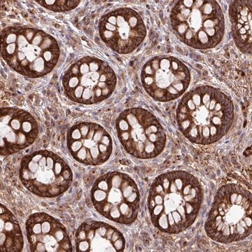 Anti-LSM12 antibody produced in rabbit Prestige Antibodies&#174; Powered by Atlas Antibodies, affinity isolated antibody, buffered aqueous glycerol solution
