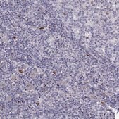 Anti-SLC9A3R2 Prestige Antibodies&#174; Powered by Atlas Antibodies, affinity isolated antibody