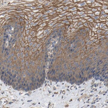 Anti-TNFSF15 antibody produced in rabbit Prestige Antibodies&#174; Powered by Atlas Antibodies, affinity isolated antibody, buffered aqueous glycerol solution