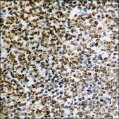 Anti-phospho-SEK1/MKK4 (pThr261) antibody produced in rabbit affinity isolated antibody