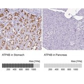 Anti-ATP4B antibody produced in rabbit Prestige Antibodies&#174; Powered by Atlas Antibodies, affinity isolated antibody, buffered aqueous glycerol solution