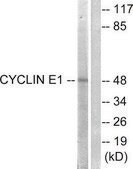 Anti-Cyclin E1 antibody produced in rabbit affinity isolated antibody