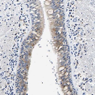 Anti-ZDHHC13 antibody produced in rabbit Prestige Antibodies&#174; Powered by Atlas Antibodies, affinity isolated antibody, buffered aqueous glycerol solution